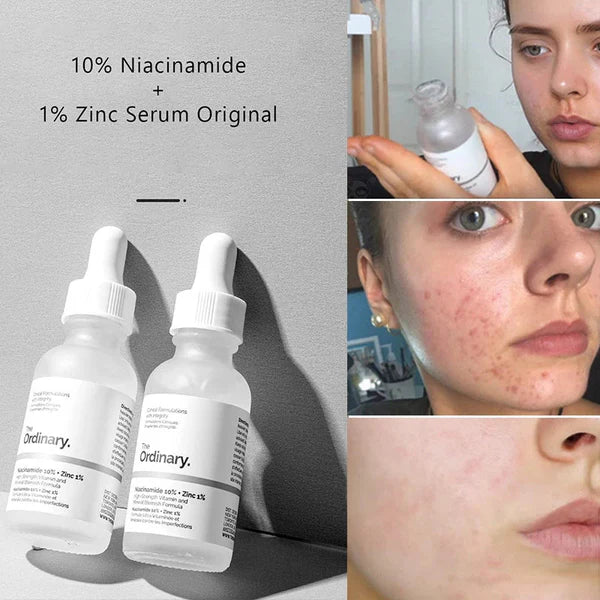 The Ordinary Niacinamide 10% + Zinc 1% 30Ml– (Verified✅ with Batch code)